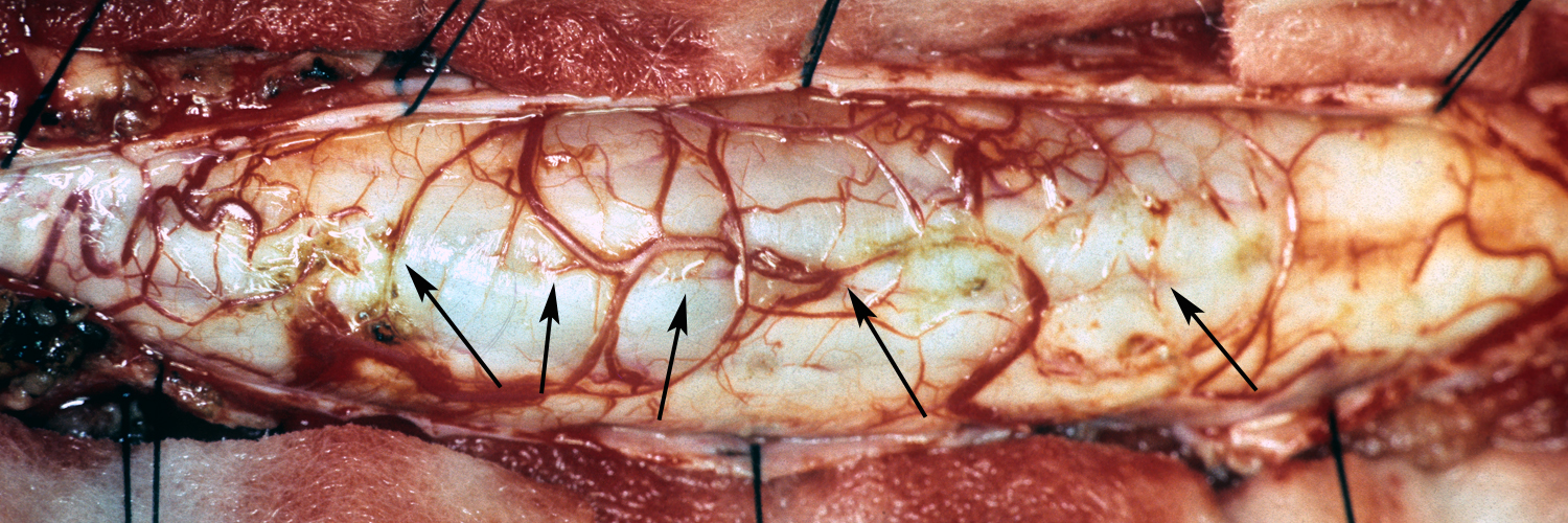 Pial vessels fo spinal cord penetrating median raphe