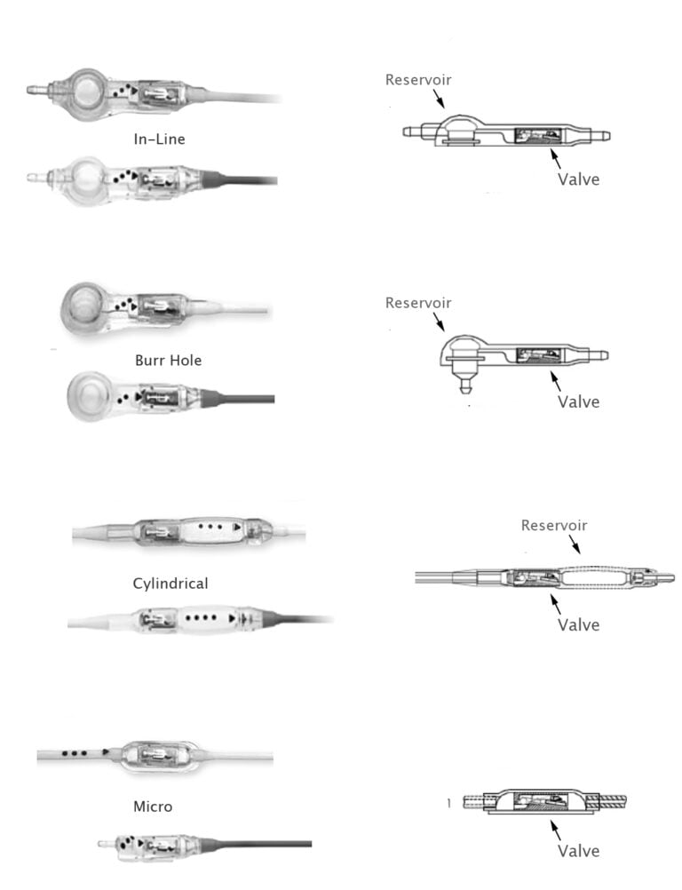 Codman Hakim Precision Pressure Differential Valves - The ISPN Guide to ...